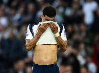 '[뉴스]“SON 떠난 토트넘 마구니가 끼었나...강등 사투속 끊이지않는 부상 악령“ 솔란케‥ 뉴스기사 썸네일