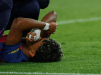 '[뉴스]“충격!“ 스페인 축구 천재, 고통스러운 표정→눈물 흘리며 부상 OUT…라민 야말,‥ 뉴스기사 썸네일